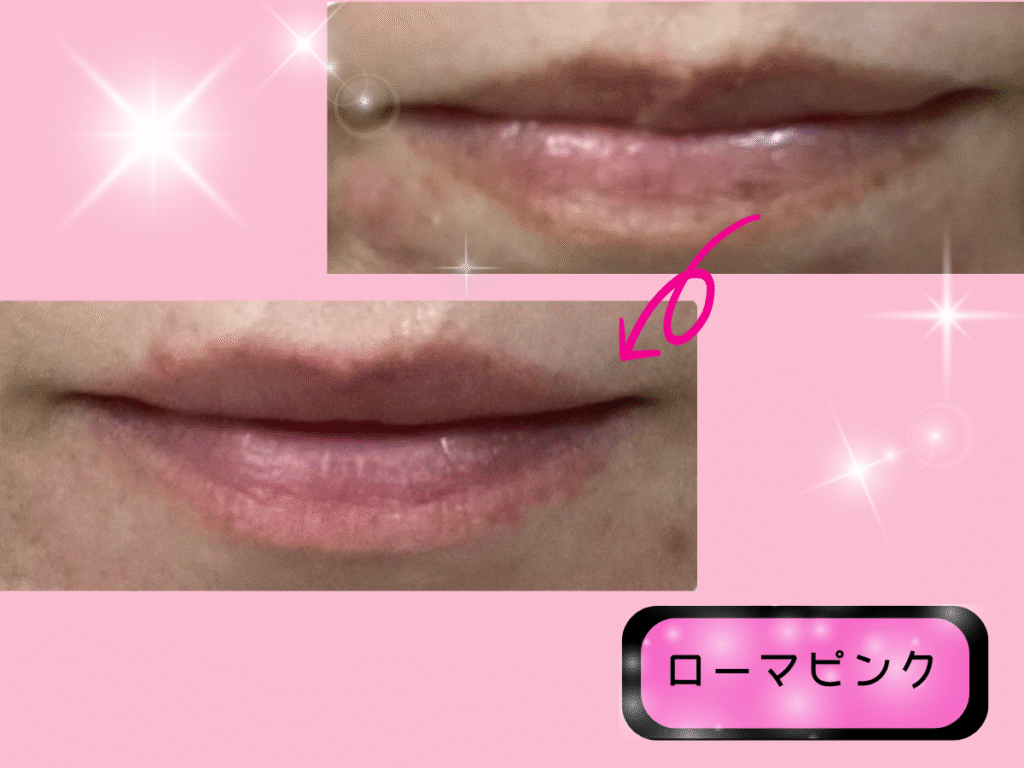 メラニンケア「ローマピンク」を唇にした結果☆ - そばにある、feliz