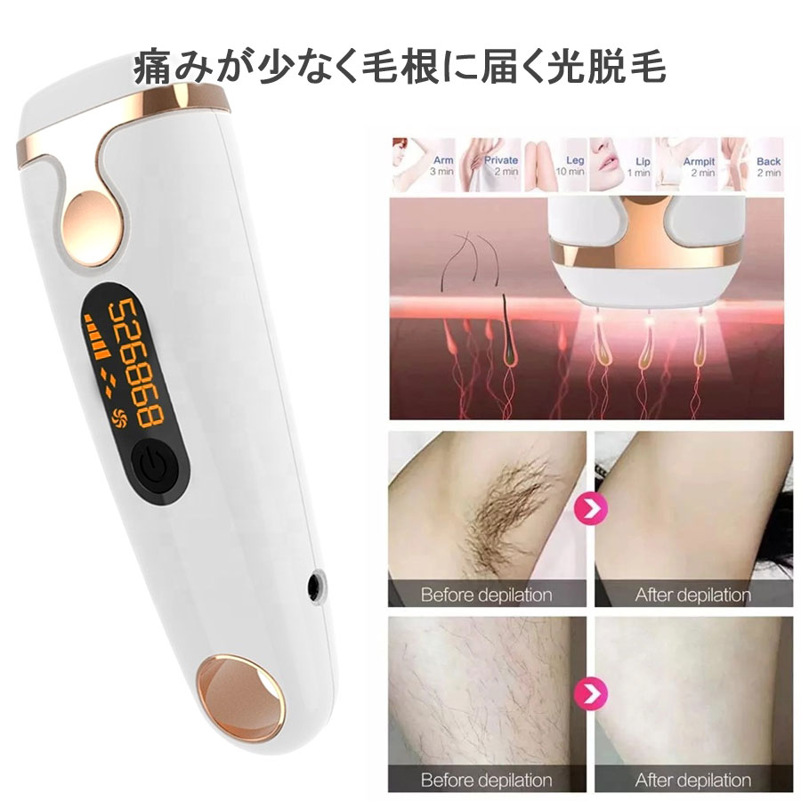 楽天市場】99万回以上 IPL 脱毛器 フラッシュ 男性 女性 ノンレーザー