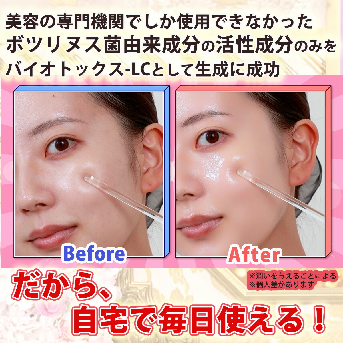 楽天市場】クウィーントックス パーフェクトバイオセラム 美顔器セット