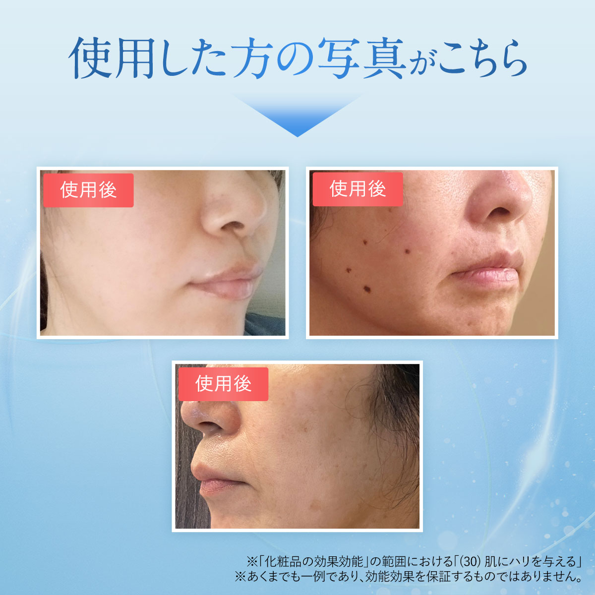 楽天市場】【10%OFFクーポン配布中】[新発売]ほうれい線 特化パッチ