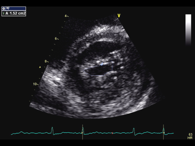 動画を見て学べる！心エコーレポート実例集50｜付録動画