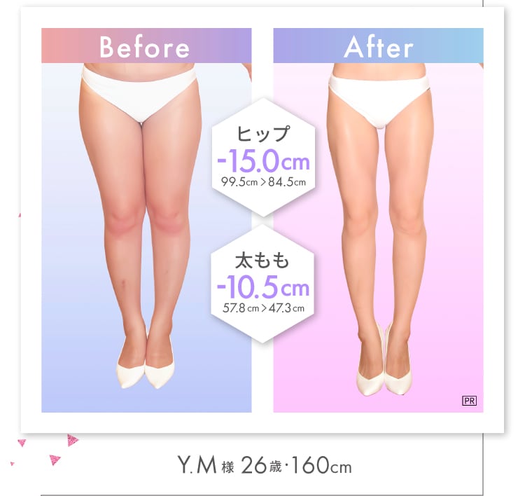 セルライト特化型だから脚やせが効果的にかなう！モデル美脚ブースト