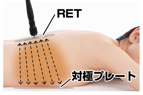 RAFOS premium】ラジオ波・高周波温熱機器・RF 筋膜リリース｜ 誠鋼社