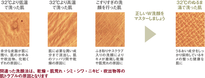 シャンソン化粧品 セルキス