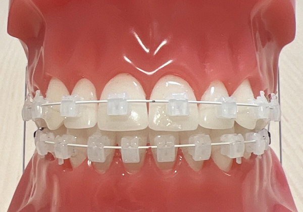 矯正治療について｜稲毛駅徒歩3分の矯正歯科｜つみき矯正歯科稲毛