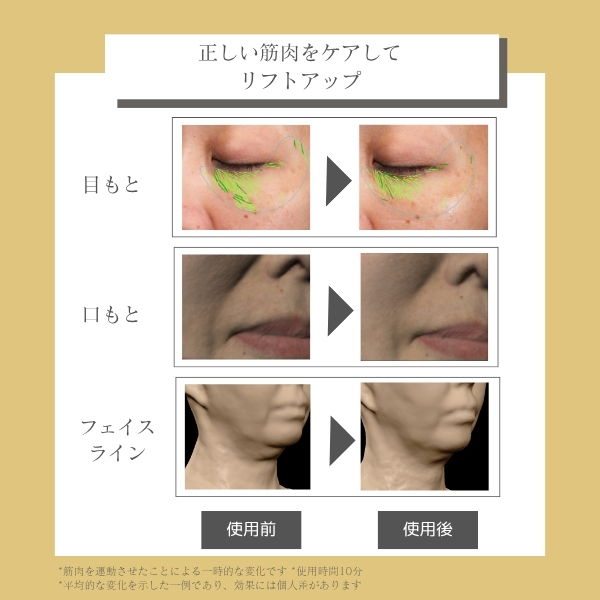 デザインリフトモア｜ヤーマン公式通販サイト | ヤーマンオンラインストア