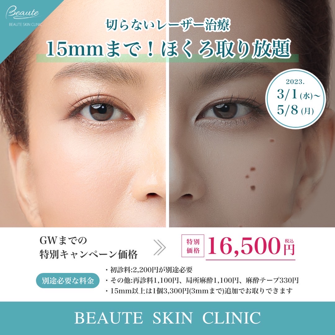 ほくろ取り放題15㎜まで16,500円！！5月8日まで | ボーテスキン