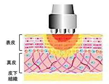 BE-BE | 製品情報 | BECO JAPAN