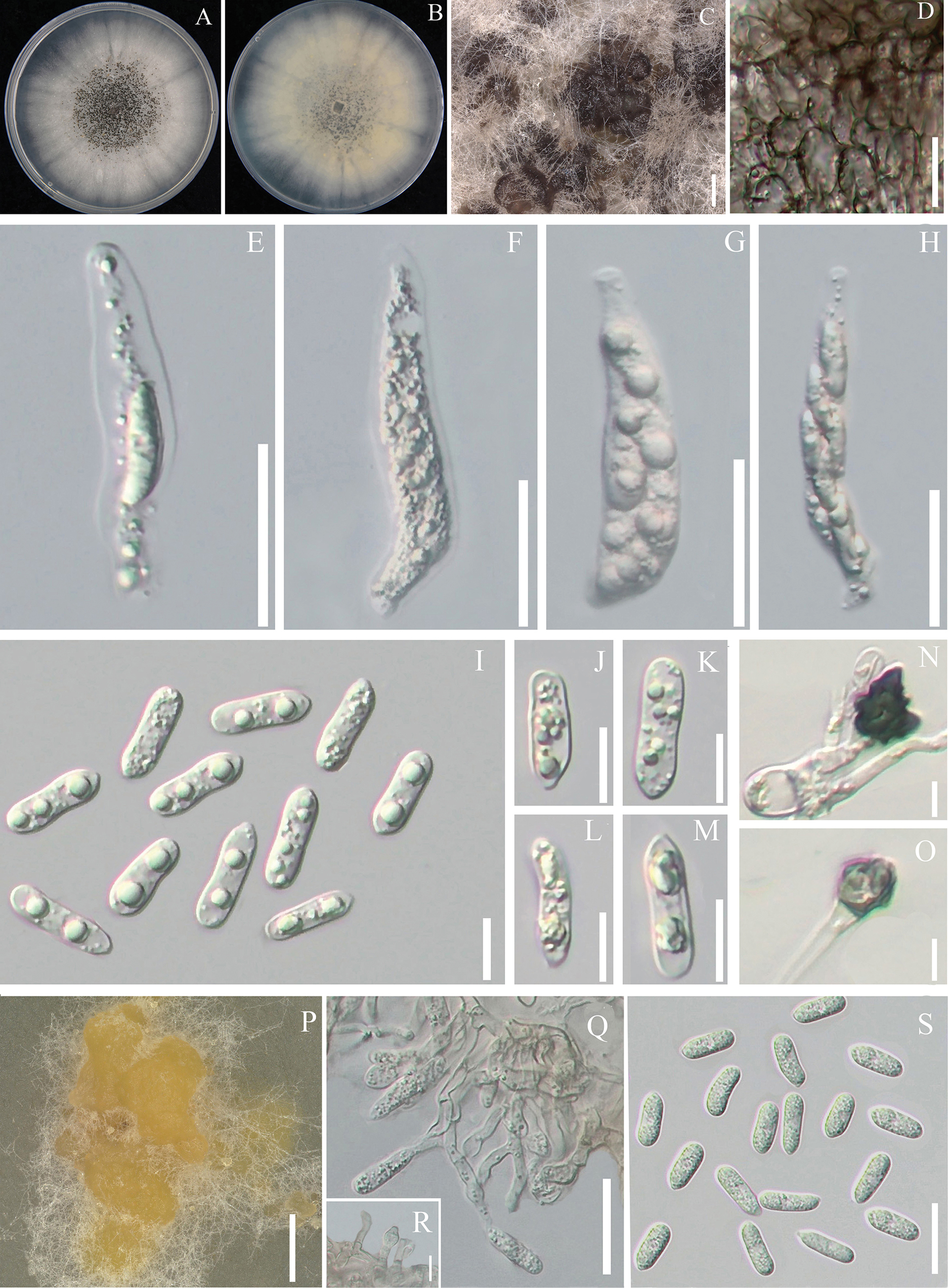Two new species of Colletotrichum (Glomerellales, Glomerellaceae