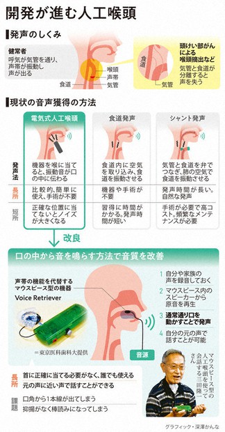 科学の森：失った声、取り戻す「人工喉頭」 | 毎日新聞