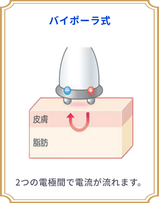 サロンに最適な業務用エステ痩身機器をご提案｜株式会社E-Surprise