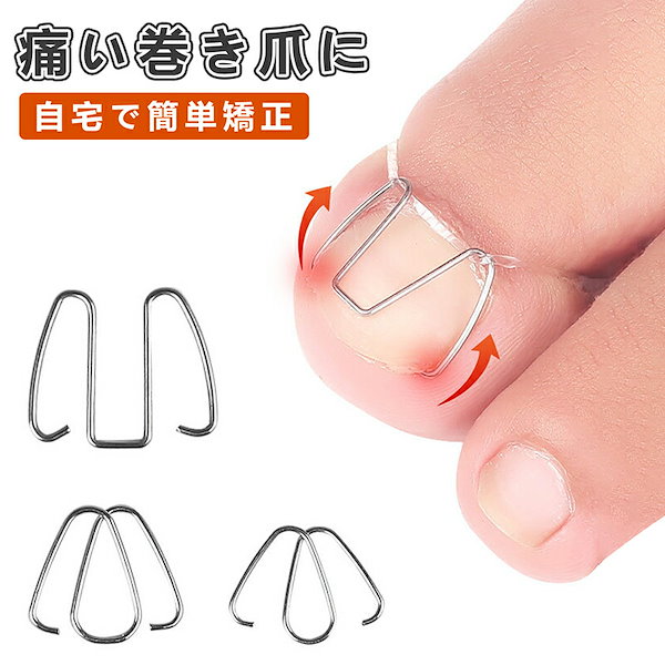 Qoo10] 巻き爪 矯正 セット 自分で 爪ワイヤー
