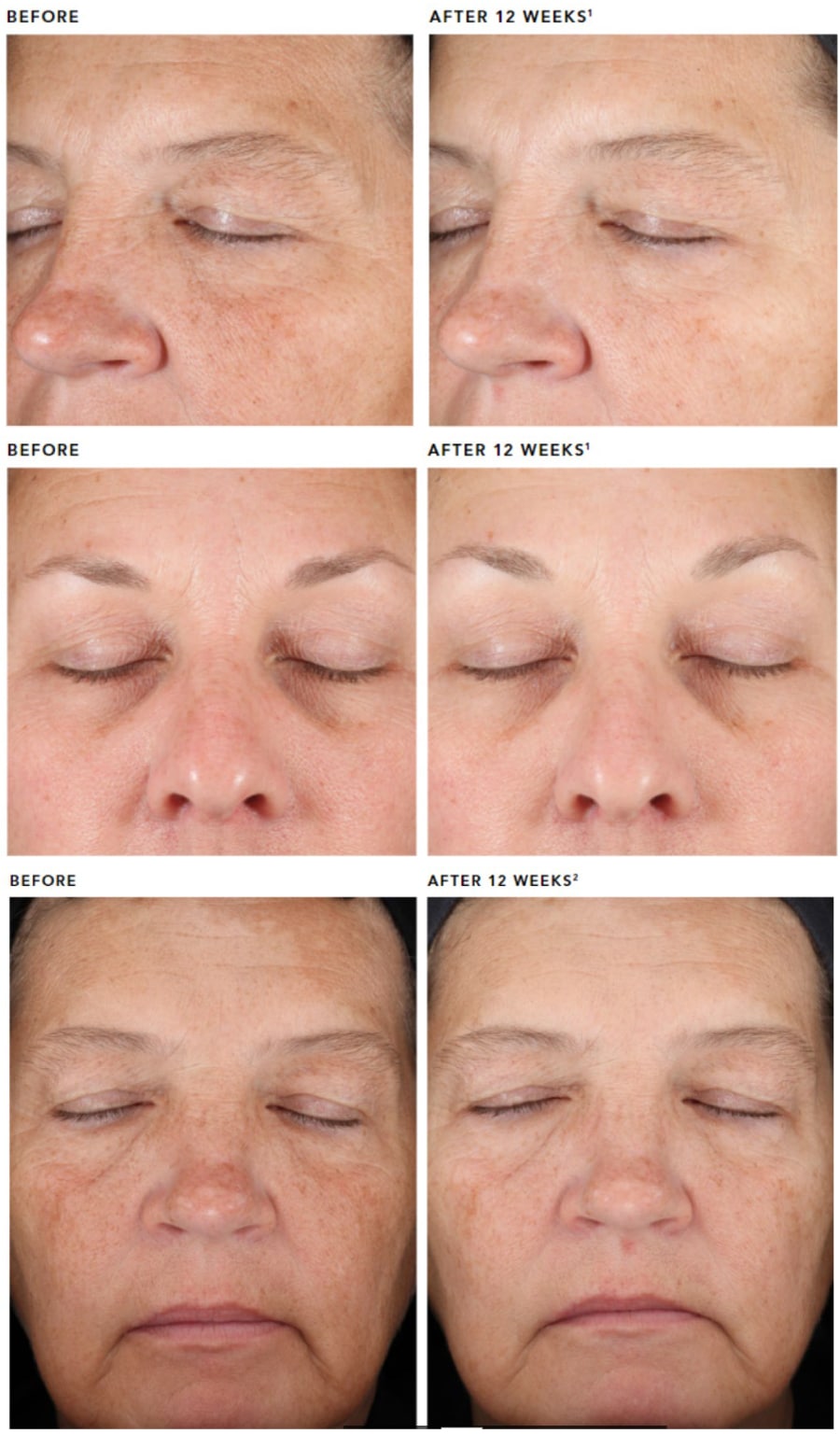 リビジョン DEJ フェイスクリーム (DEJ face cream) Revision｜正規