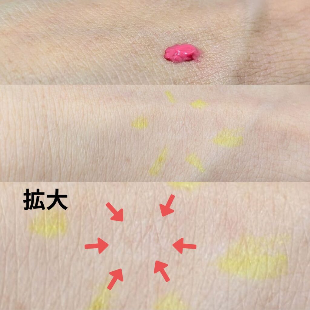 医師解説】ローマピンクはアフタークリームだけでも効果あるかも