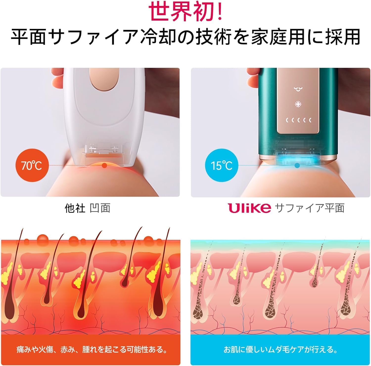 月額5,380円レンタルプラン：Ulike ユーライク 脱毛器 Air Pro UI04CJP