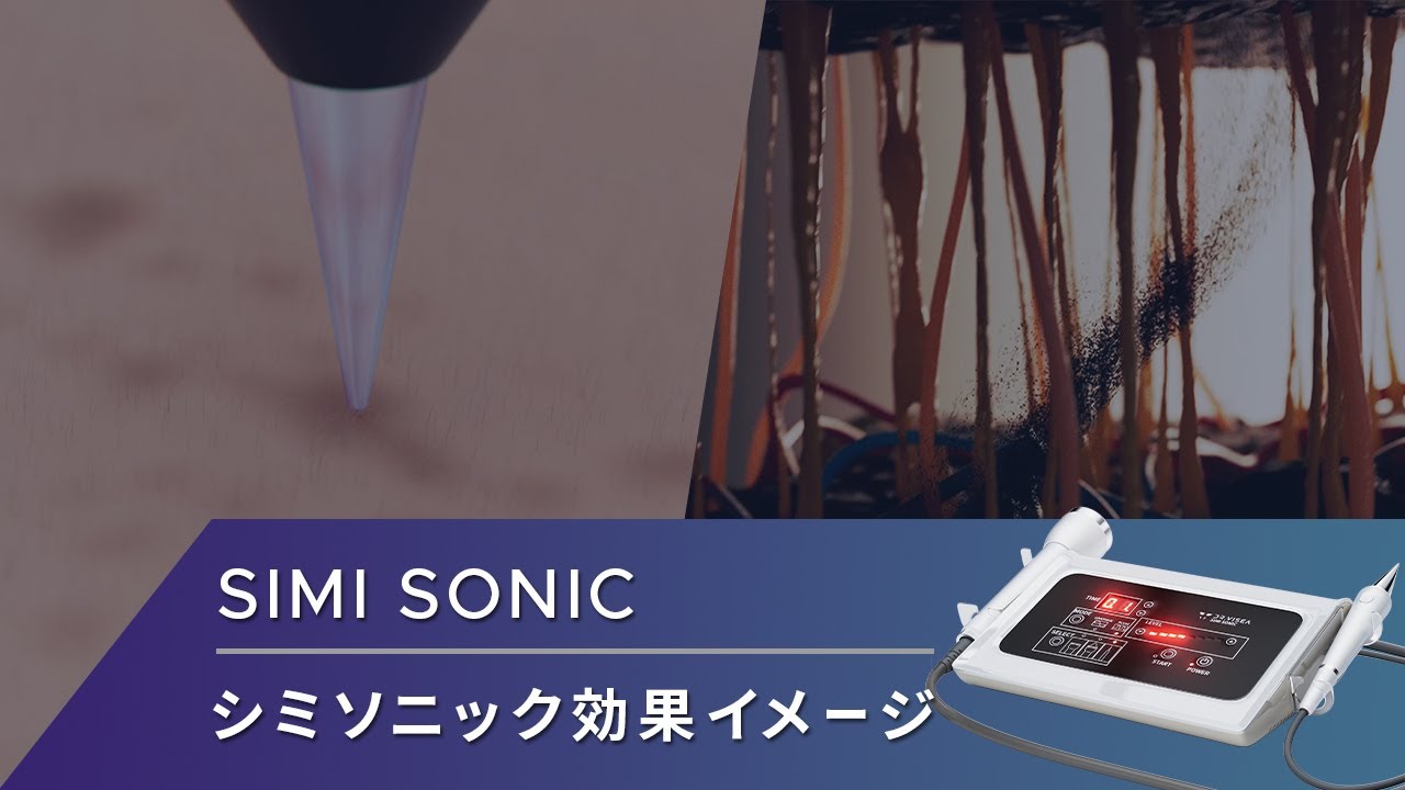 サロン導入可能なシミ取り機械を調査・比較してみました - 【公式