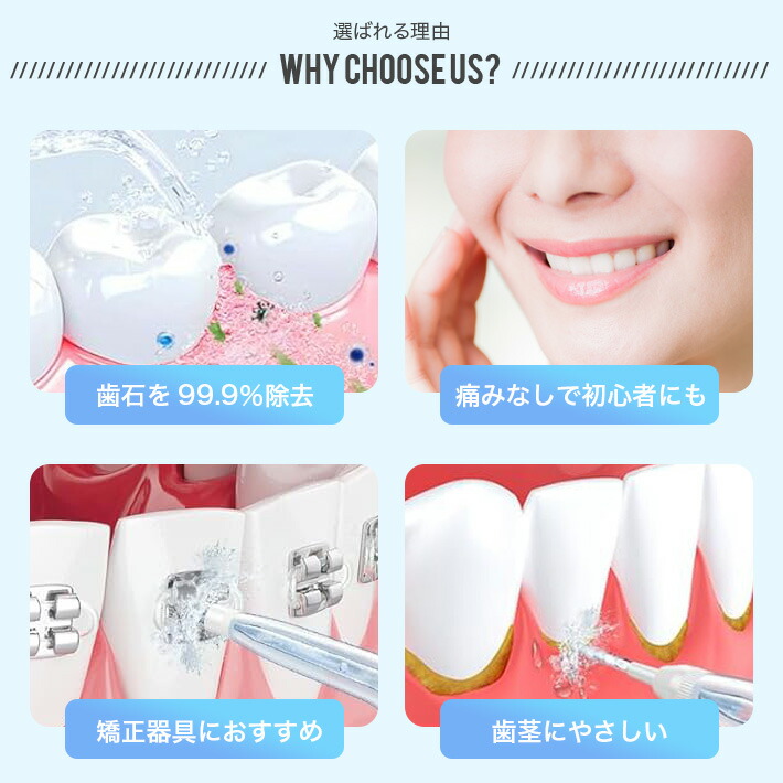 楽天市場】口腔洗浄器 ジェットウォッシャー 歯垢除去率99.9% 4種類
