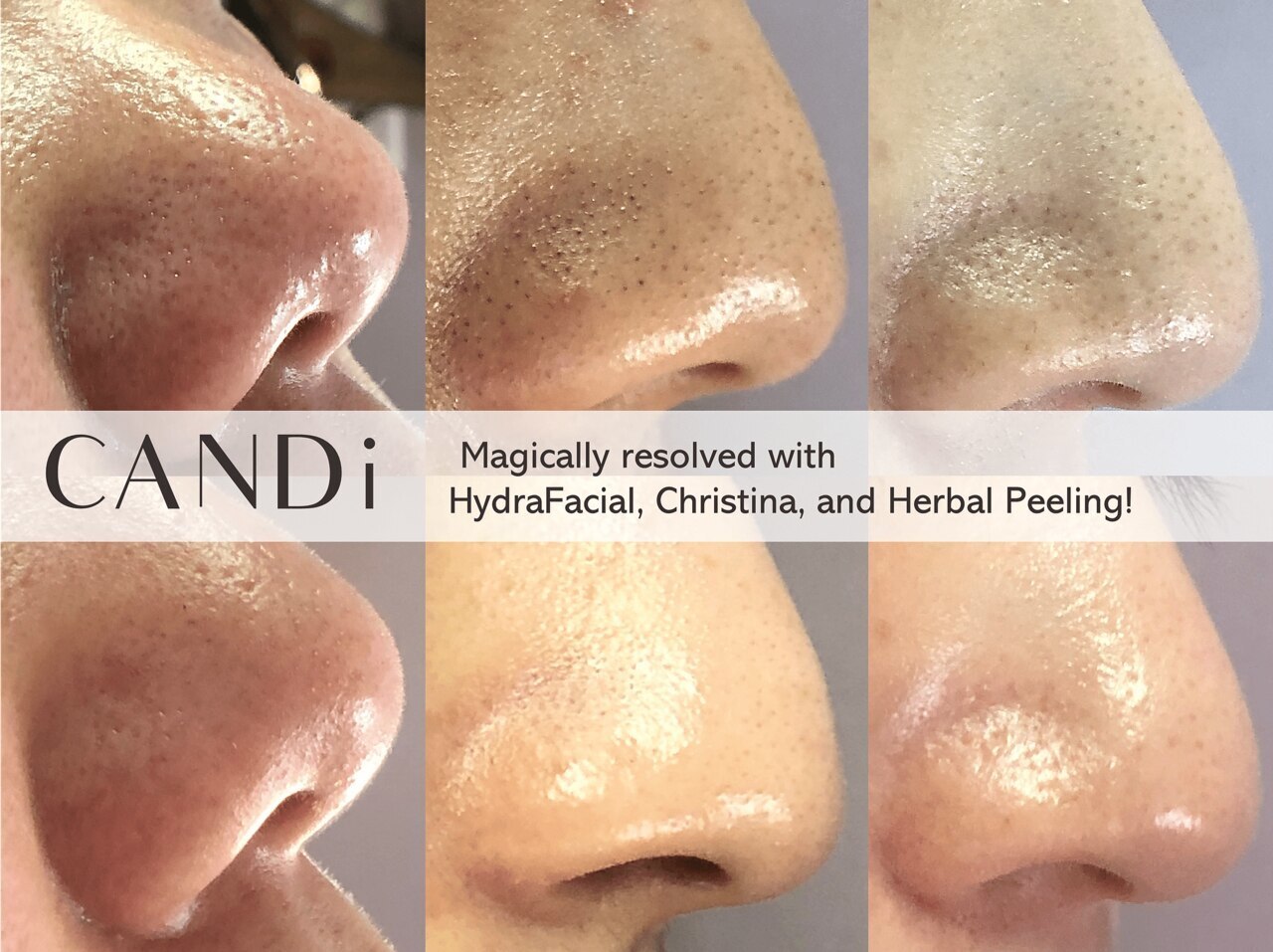 キャンディ 大阪梅田店(CANDi)｜ホットペッパービューティー