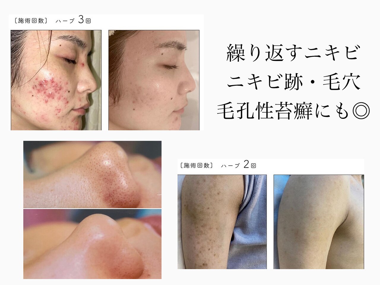 ビオプラス(BioPlus+)｜ホットペッパービューティー