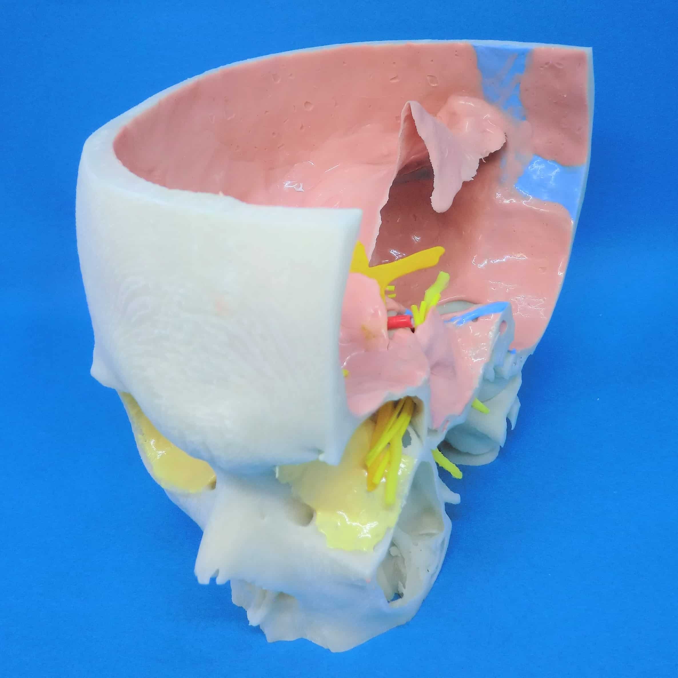 頭蓋底右側+硬膜+血管+神経（小脳テント付） A24-3の医療模型 | 3D