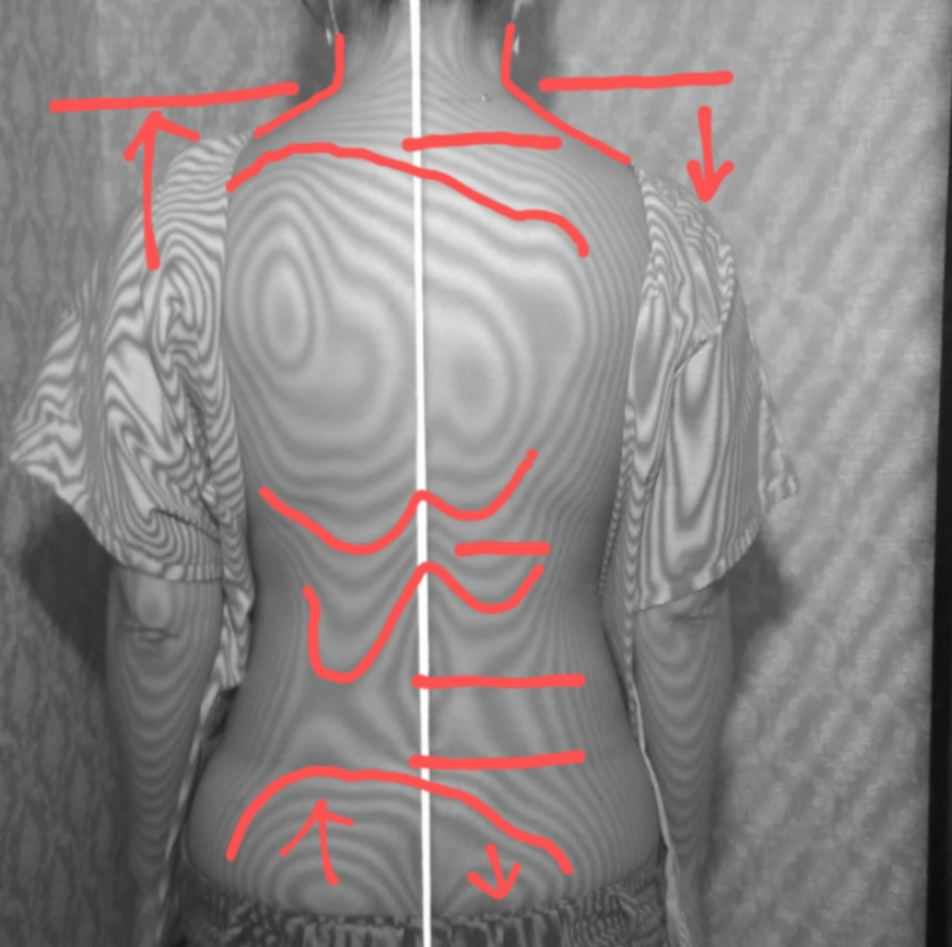 船橋の整体師が身体の歪みを写真に撮る理由 | 施術について | 身体での
