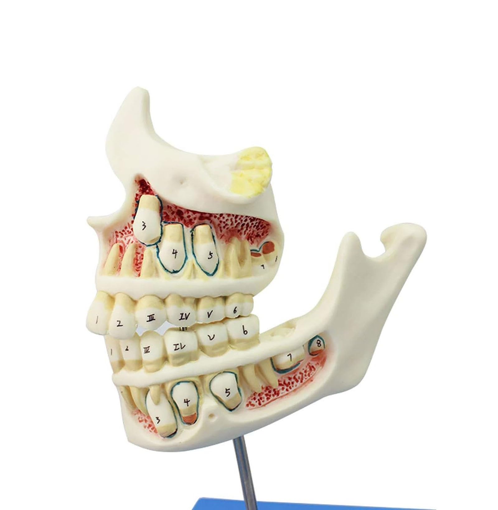 Amazon.co.jp: 歯列模型 乳歯、永久歯、子どもの歯と顎の発達モデル
