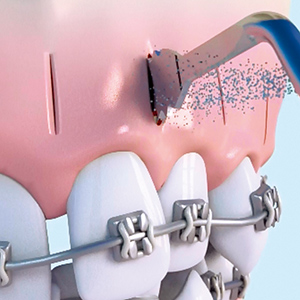 お知らせ｜三井病院歯科矯正｜川越市の歯科・口腔外科・矯正歯科