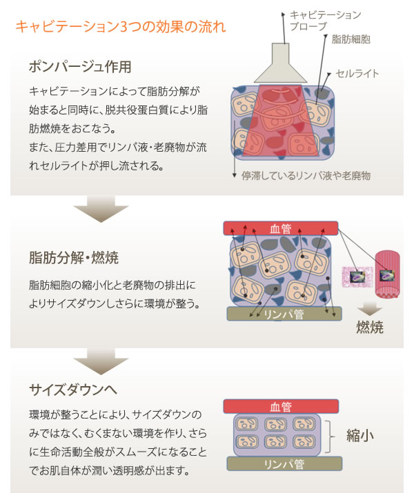 パイラバーストNEO of ㈱moise｜㈱モイセ｜エステ美容機器・エステ開業