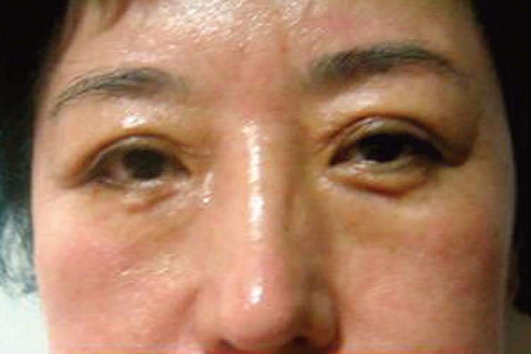 エレクトロポレーション｜高津駅前なかしま皮ふ科クリニック｜高津区