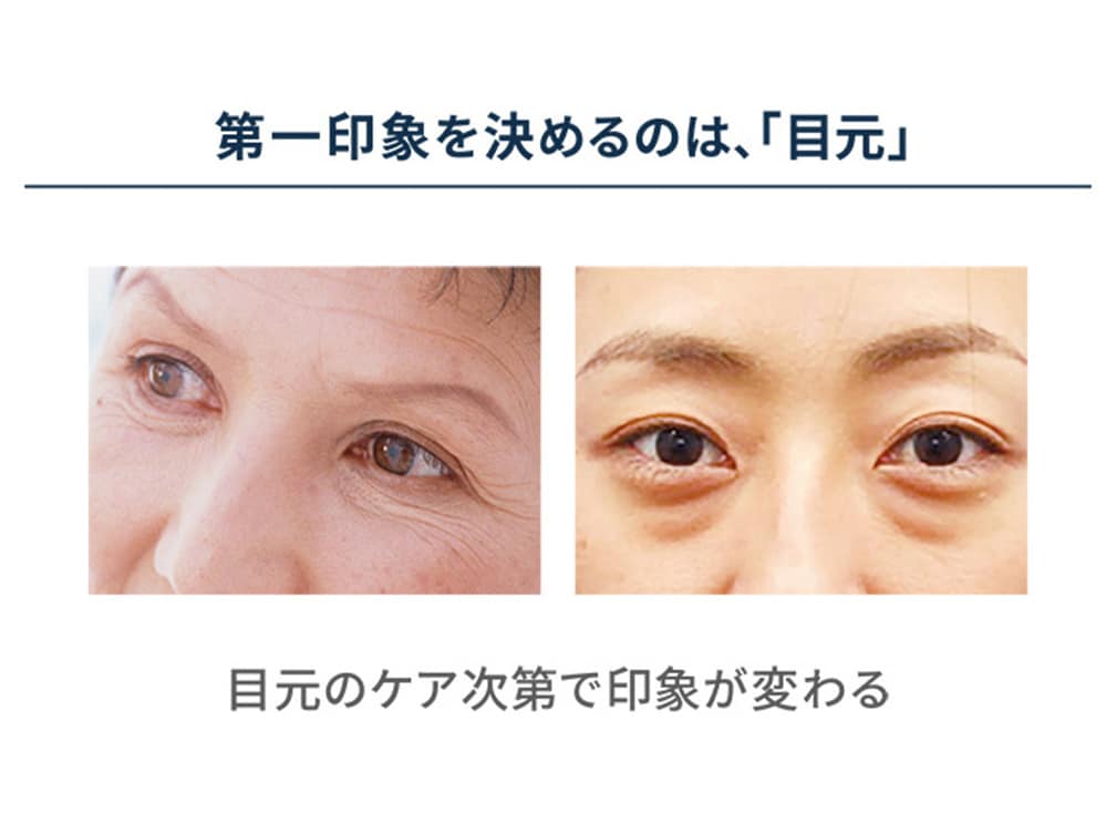 YA‐MAN（ヤーマン） YA-MAN クリアージュ 家庭用美容機器 アイリフト