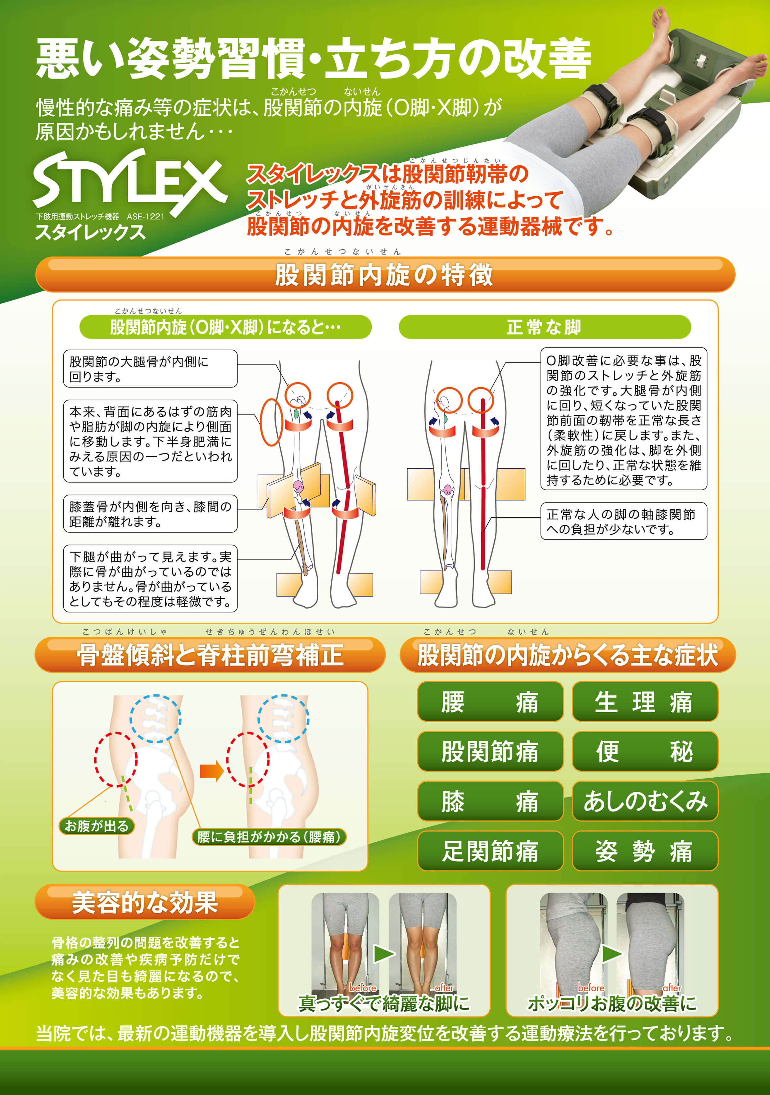 O脚矯正 | 下関市の整体なら女性人気NO1しんしも駅前カイロ